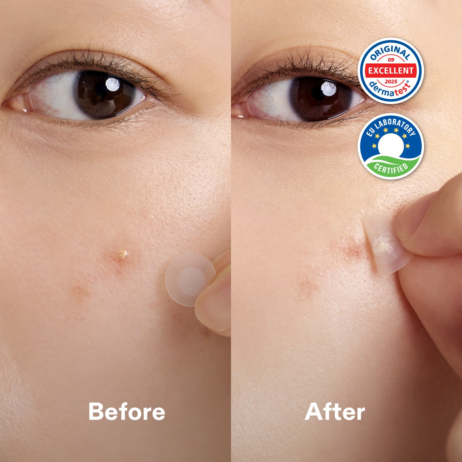 Centella Pimple Patch