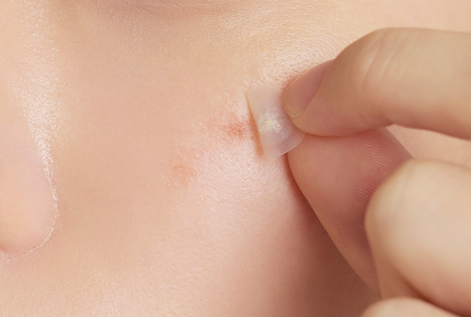 <p><strong>Protective </strong>Barrier</p>