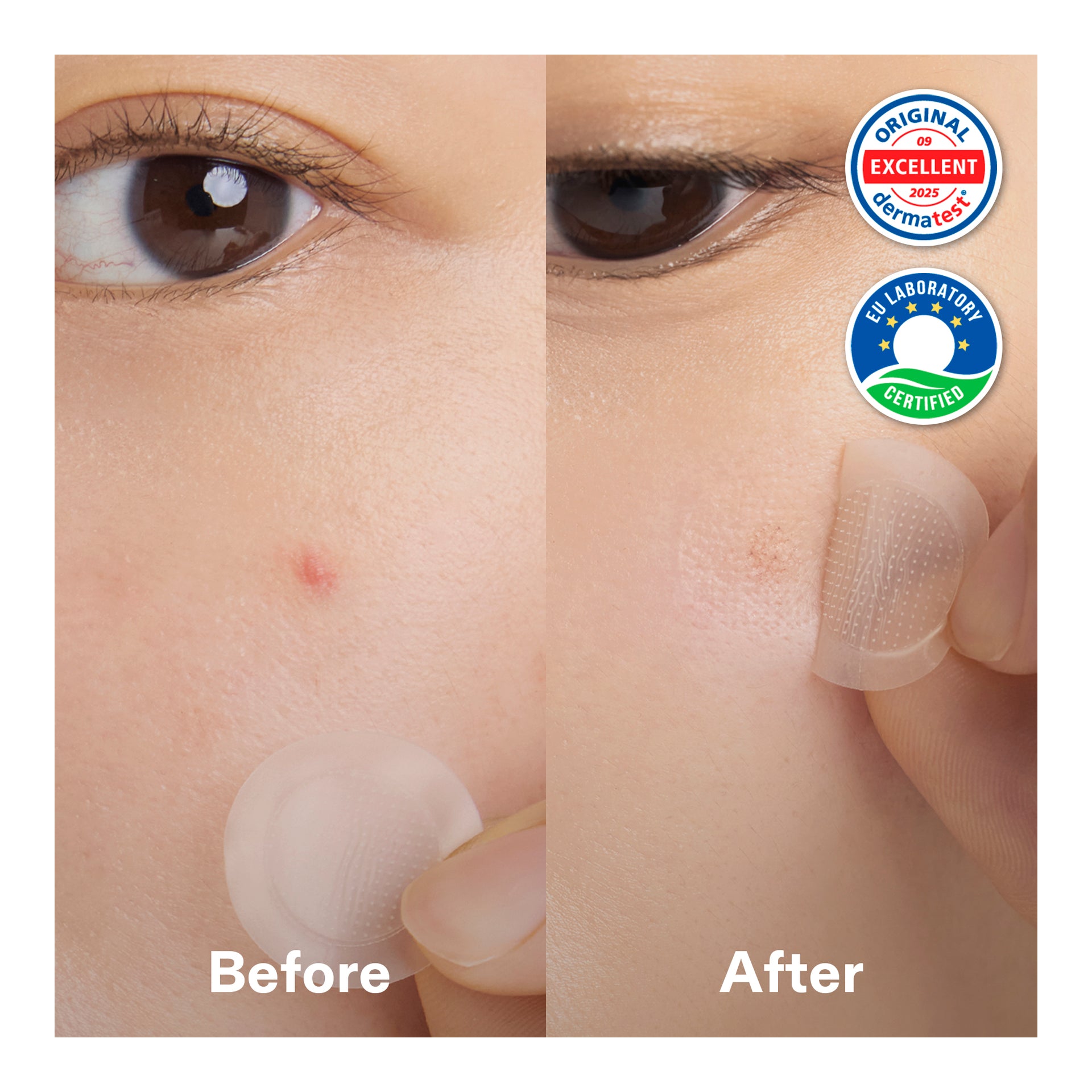 Niacinamide Micro Darts Patch